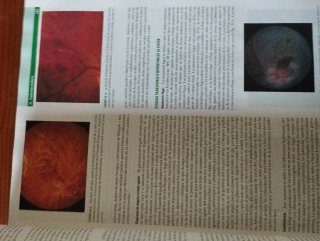 Dos libros de medicina interna Harrison