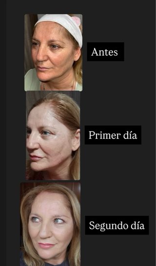 Todo lo relacionado con estetica