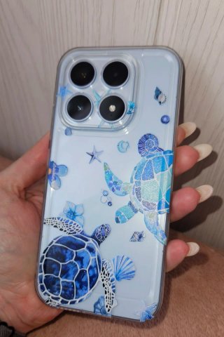Pack 3 Fundas Xiaomi 17 NUEVAS