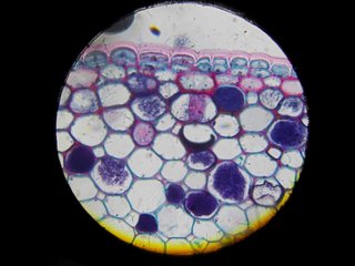Microscopio Lomo con 3 objetivos Leitz