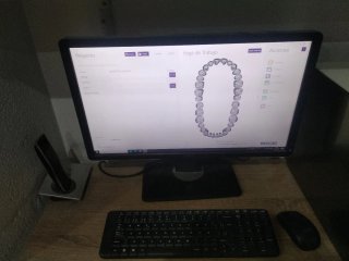 Escáner Dental Smart Optics Scan Box