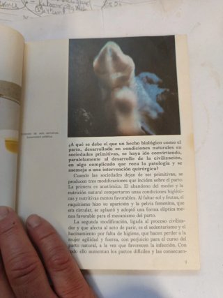 El nacimiento de un niño