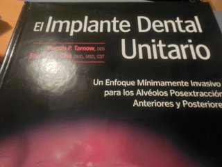 El implante dental unitario un enfoque mínimame...