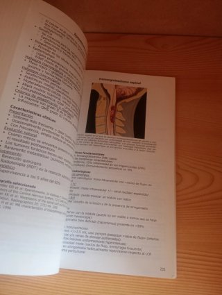 Los 100 diagnósticos principales columna vertebral