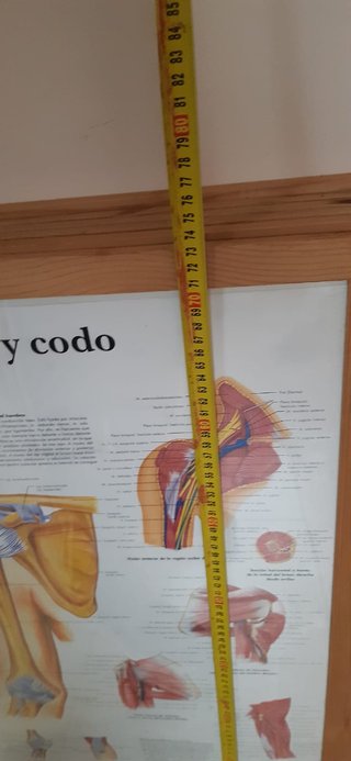 LAMINA DE ANATOMIA-LA APOPLEJIA