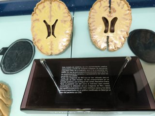 Modelo de Cerebro Humano Sanofi Genzyme