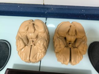 Modelo de Cerebro Humano Sanofi Genzyme