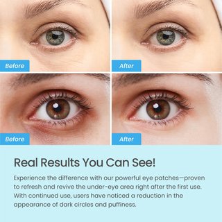 3 Cajas Parches Ojos Plantifique (36 Pares) NUEVO