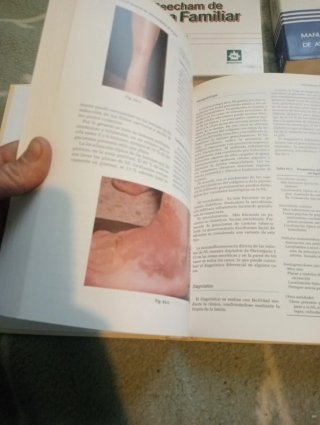 Manual Janssen de enfermedades de la piel
