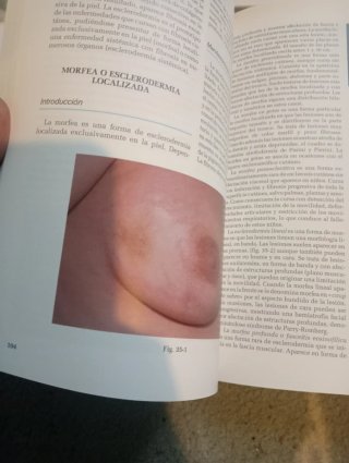 Manual Janssen de enfermedades de la piel