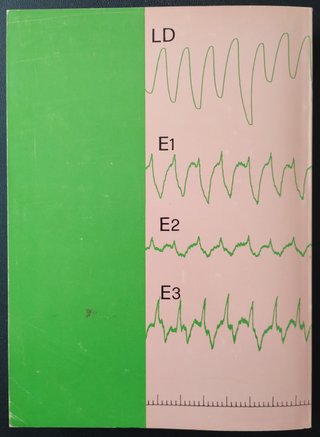 Disturbi della motilità GASTROINTESTINALE +2Omaggi