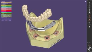 HP Zbook Fury + Exocad 3.3 Dental PC