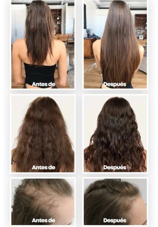 Champú Simycare Y Mascarilla