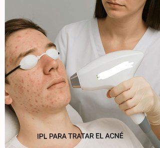 Máquina Foto Depilación laser profesional.