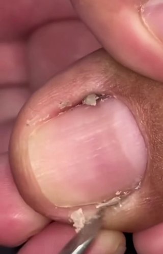 Servicio de pedicura a DOMICILIO