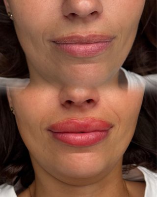 Promocion Micropigmentación de labios