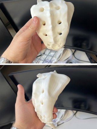 Figura coxis hueso humano