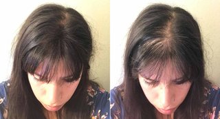 x1 Toppik Dark Brown + x1 Aplicador