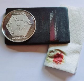 Medalla Plata 999 25 Años Conmemorativa
