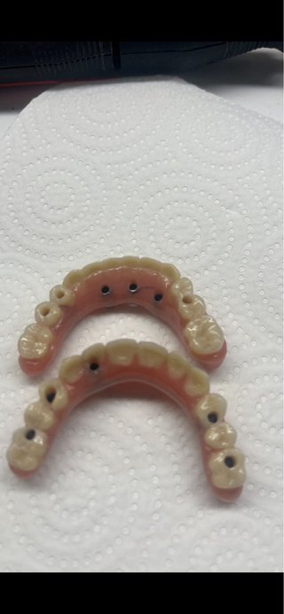 COMPOSTURA DENTAL BCN