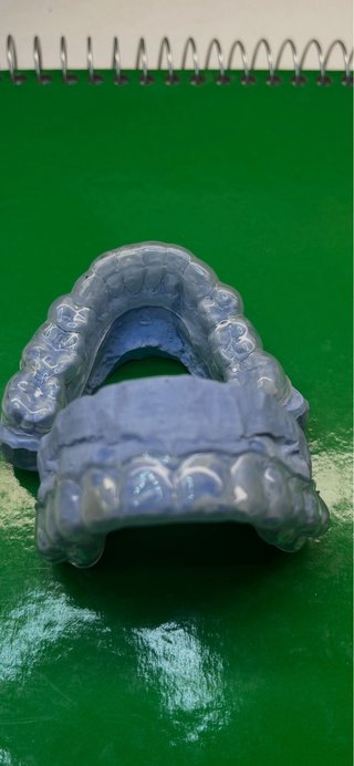 COMPOSTURA DENTAL BCN