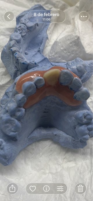 COMPOSTURA DENTAL BCN