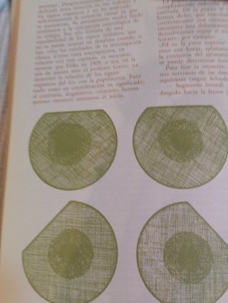 Diagnóstico Por El Iris