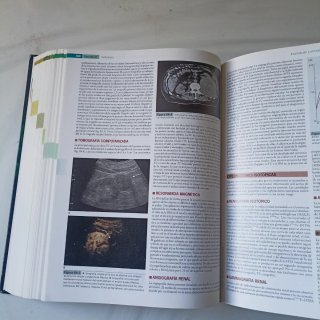 Medicina Interna Farreras Rozman