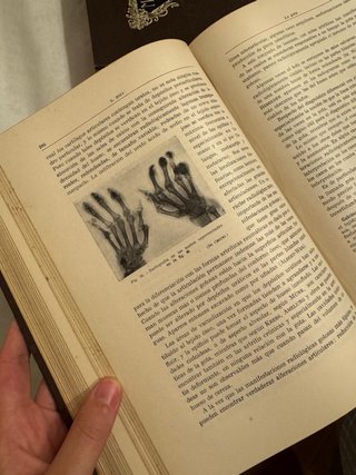 Libro antiguo de Medicina Interna - Angel Ceconi
