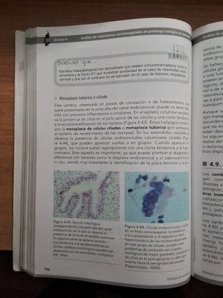 Citología ginecológica