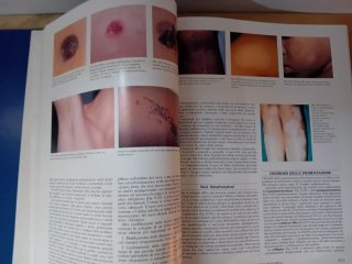 Atlante a Colori di Semeiotica Fisica in Pediatria