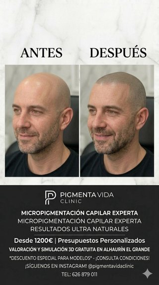 Micropigmentación capilar y cejas