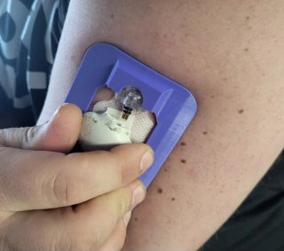 Assistente Medtronic Guardian Sensor