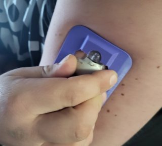 Assistente Medtronic Guardian Sensor