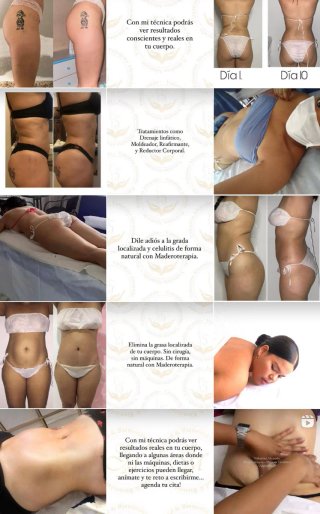 Masajes terapéuticos y profesionales
