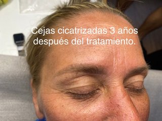 Micropigmentación Alicante Mutxamel 70€
