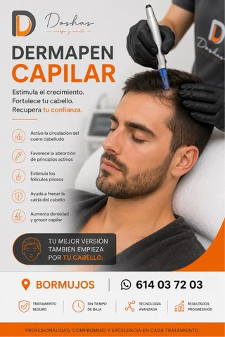 Tratamiento capilar con Dermapen