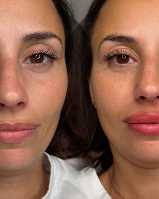 Micropigmentación labios 2 sesiones 150€