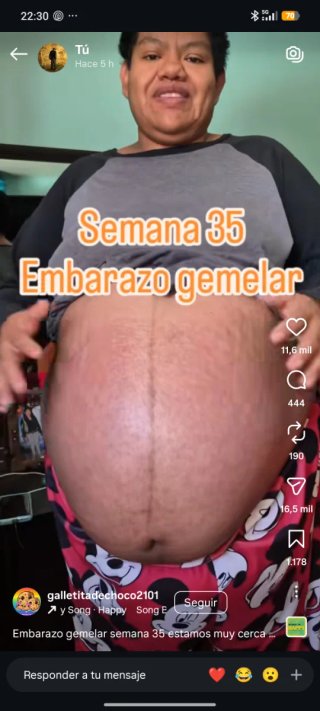 derbi senda r