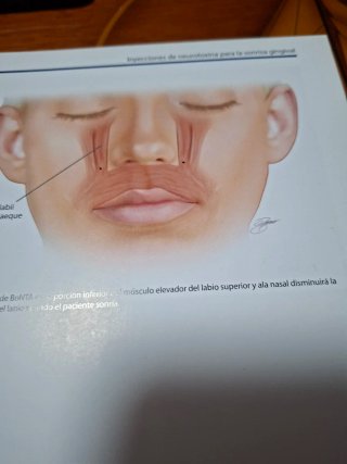 Medicina estetica en tecnicas de inyección