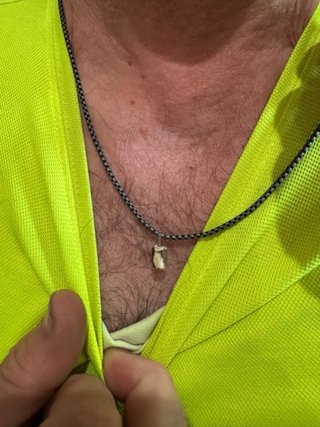 Remedio casero de raiz para las hemorroides