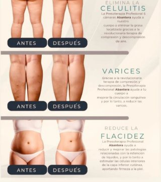 Presoterapia