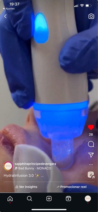 Máquina Hidrafacial Rentable Como Nueva