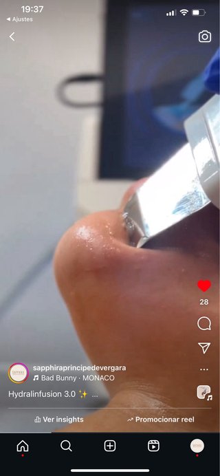 Máquina Hidrafacial Rentable Como Nueva