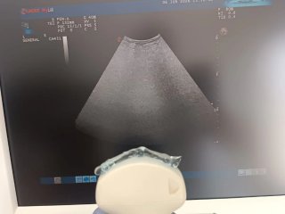 Ultrasonido Médico Esaote MyLab 60