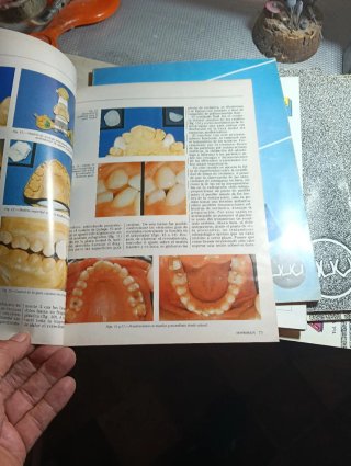 Lore de revistas prótesis dental soproden