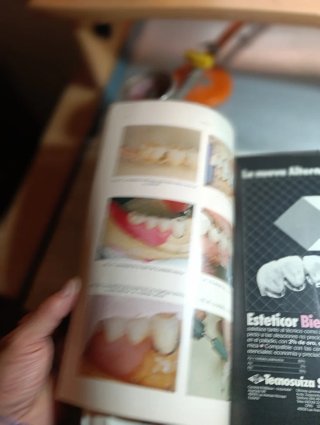 Lore de revistas prótesis dental soproden