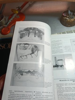 Lore de revistas prótesis dental soproden
