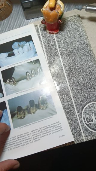 Lore de revistas prótesis dental soproden