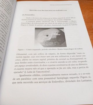 História das neurociências em Portugal